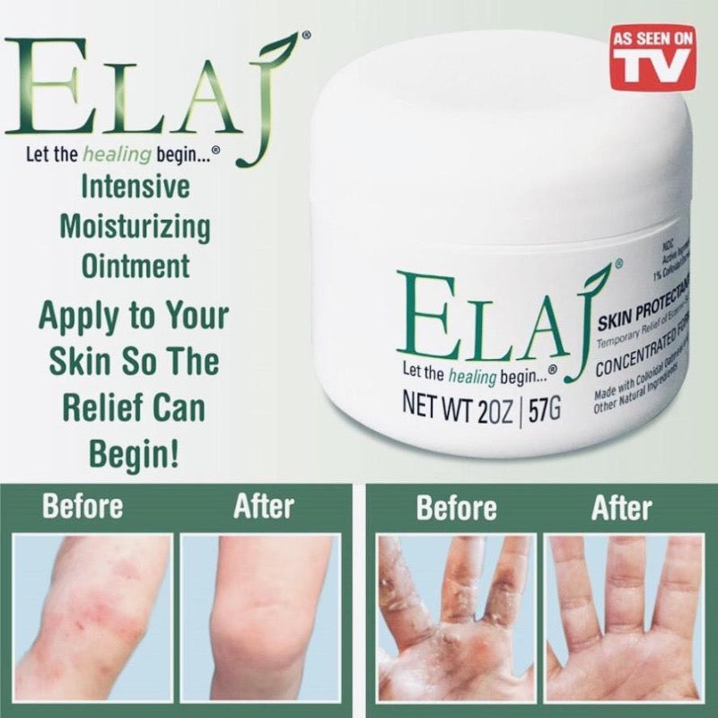 ELAJ Eczema Therapy Skin Protectant